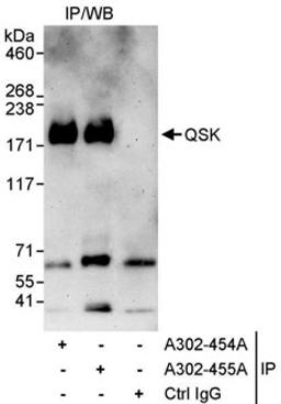 Detection of human QSK by western blot of immunoprecipitates.