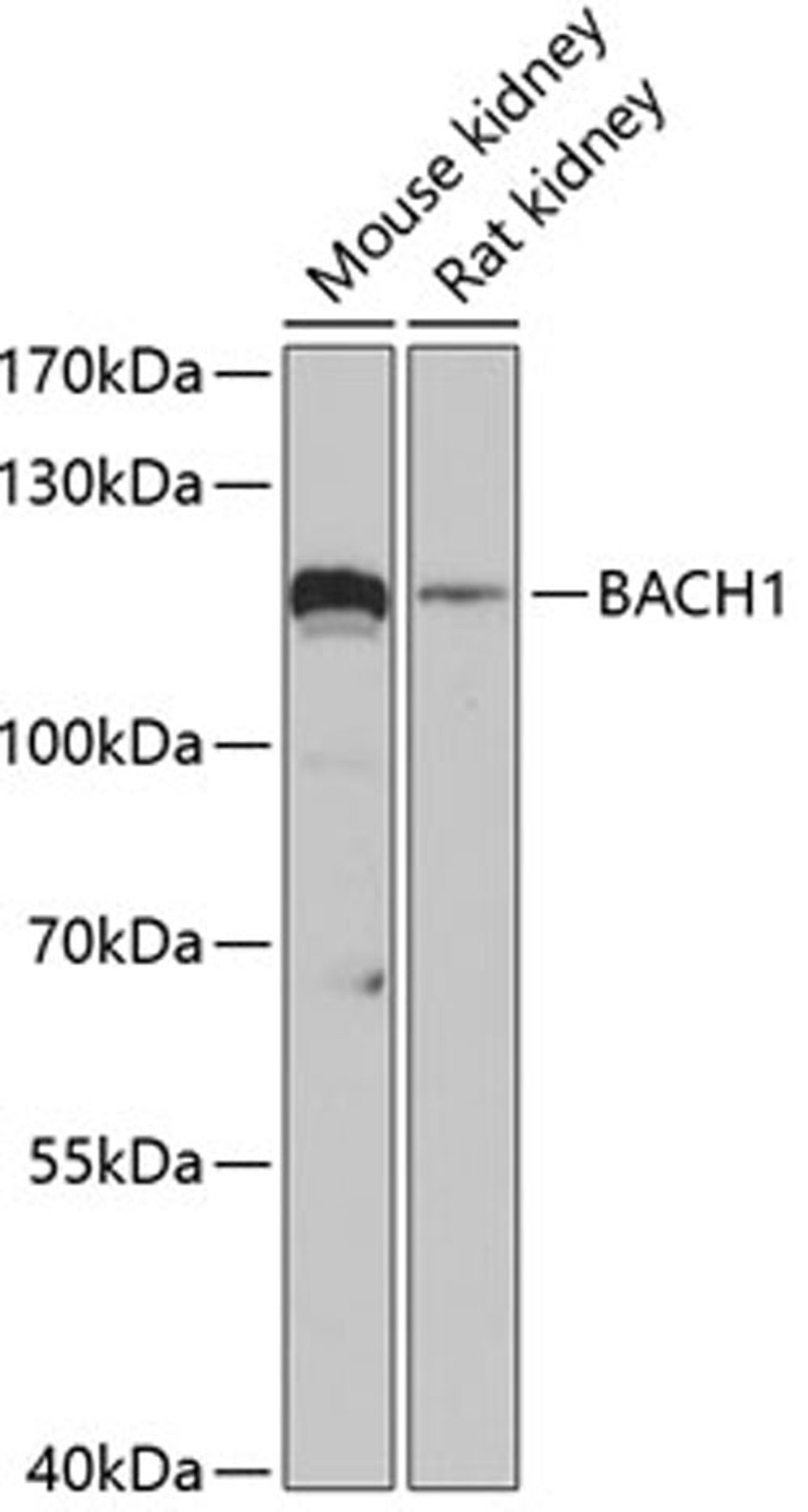 Western blot - BACH1 antibody (A5393)