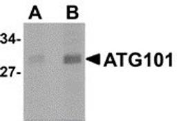 Western blot analysis of human liver lysate probed with Rabbit anti Human ATG101