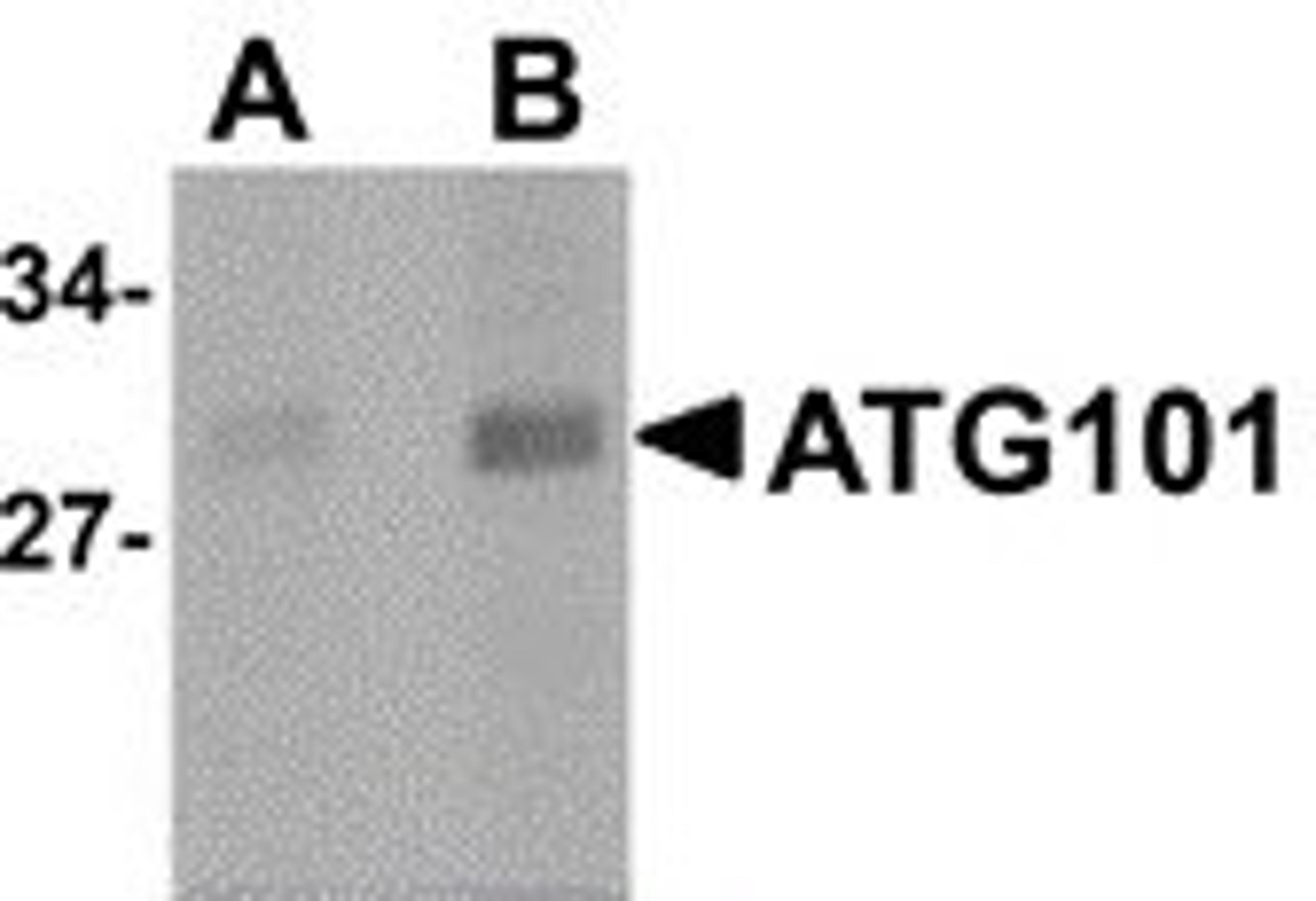 Western blot analysis of human liver lysate probed with Rabbit anti Human ATG101