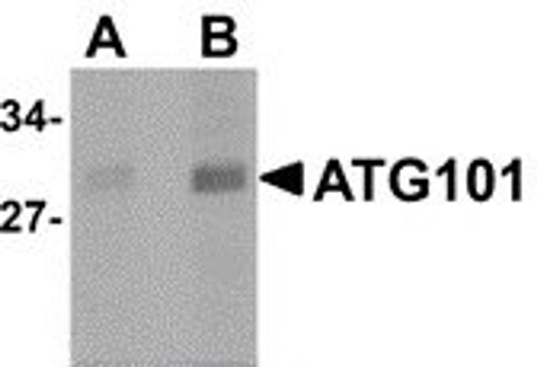 Western blot analysis of human liver lysate probed with Rabbit anti Human ATG101