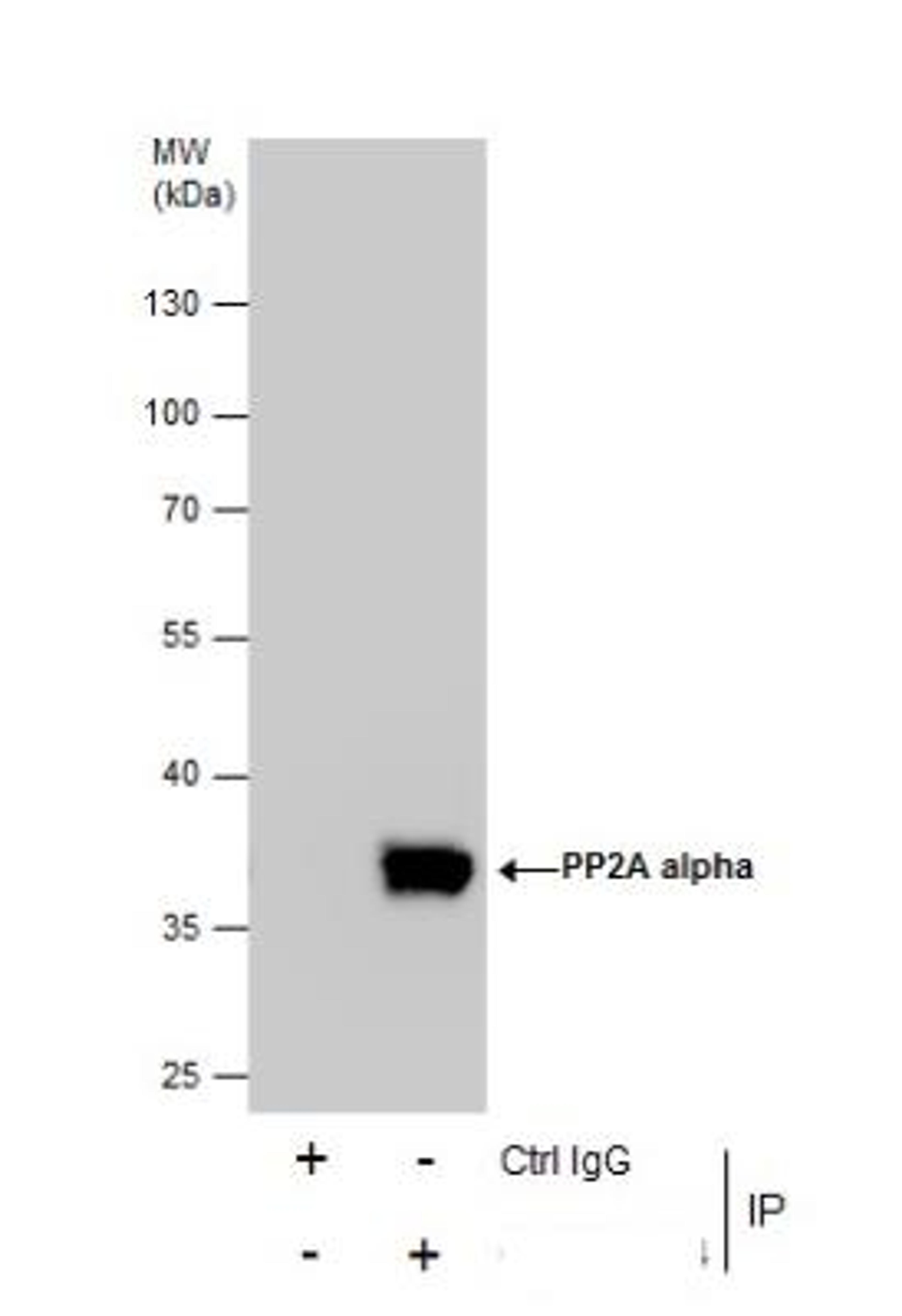 Immunoprecipitation: PP2A alpha Antibody [NBP1-31266] - Immunoprecipitation of PP2A alpha protein from 293T whole cell extracts using 5 ug of PP2A alpha antibody Western blot analysis was performed using PP2A alpha antibody. EasyBlot anti-Rabbit IgG was used as a secondary reagent.