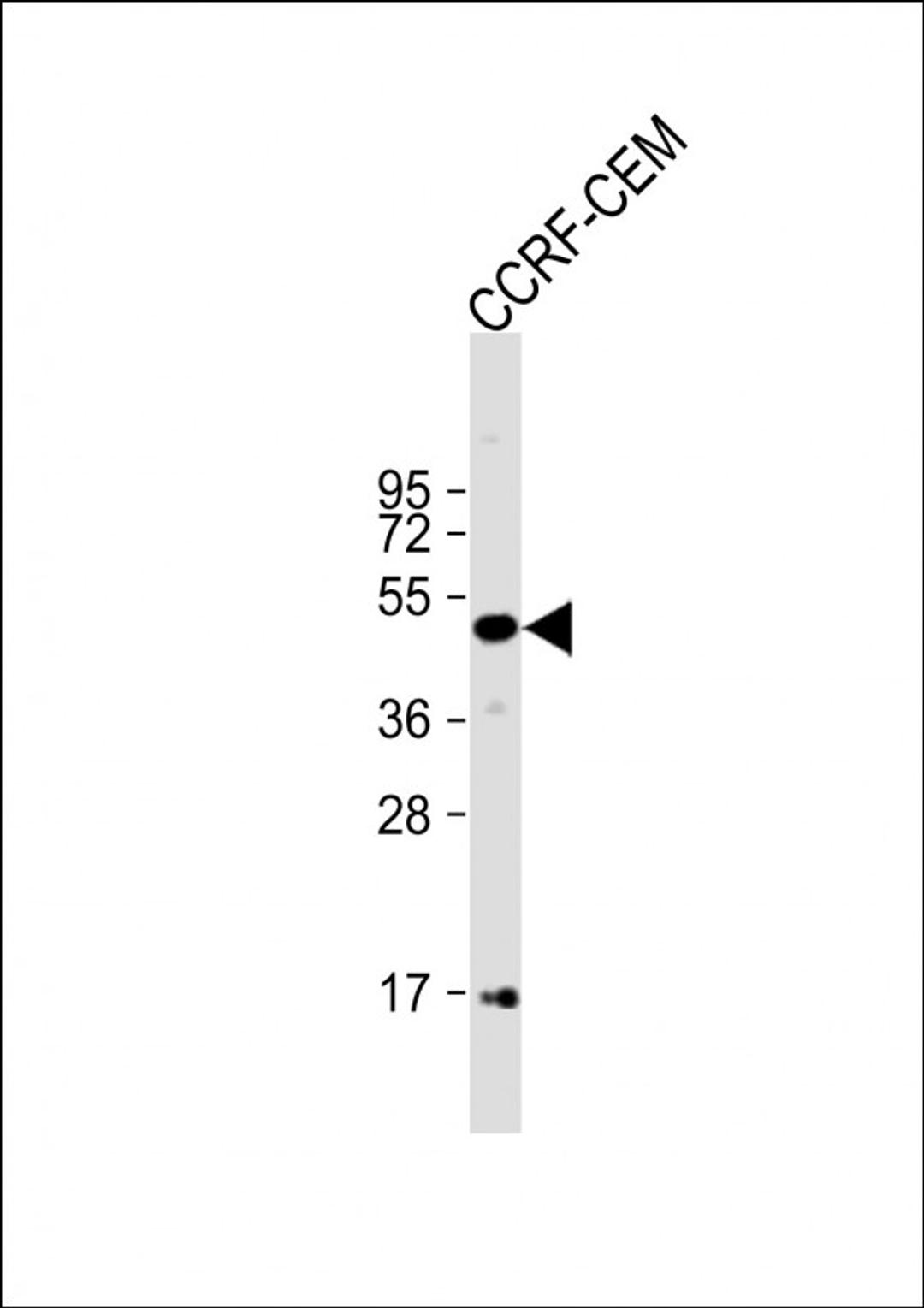 Western Blot at 1:1000 dilution + CCRF-CEM whole cell lysate Lysates/proteins at 20 ug per lane.