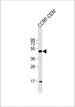Western Blot at 1:1000 dilution + CCRF-CEM whole cell lysate Lysates/proteins at 20 ug per lane.