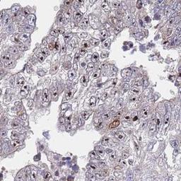 Immunohistochemistry: FAM71E1 Antibody [NBP2-31870] - testis cancer