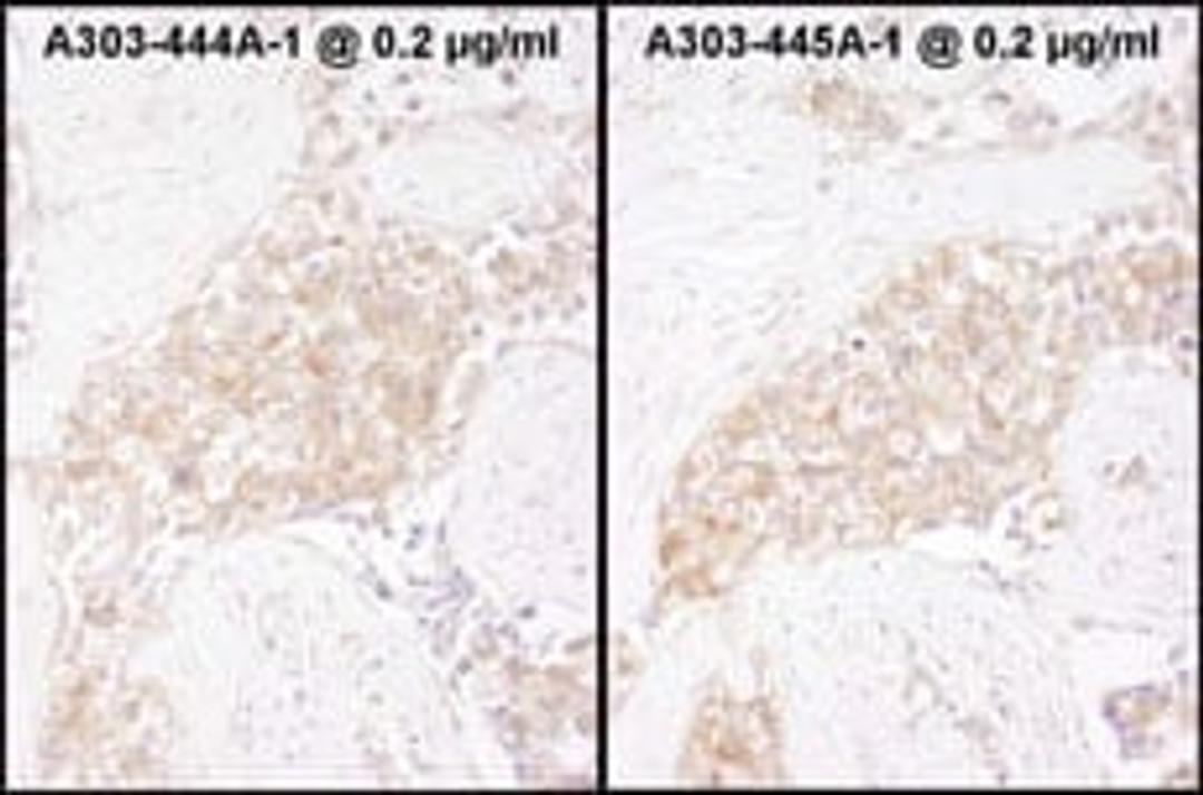 Detection of human TCP1 by immunohistochemistry.