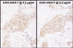 Detection of human TCP1 by immunohistochemistry.