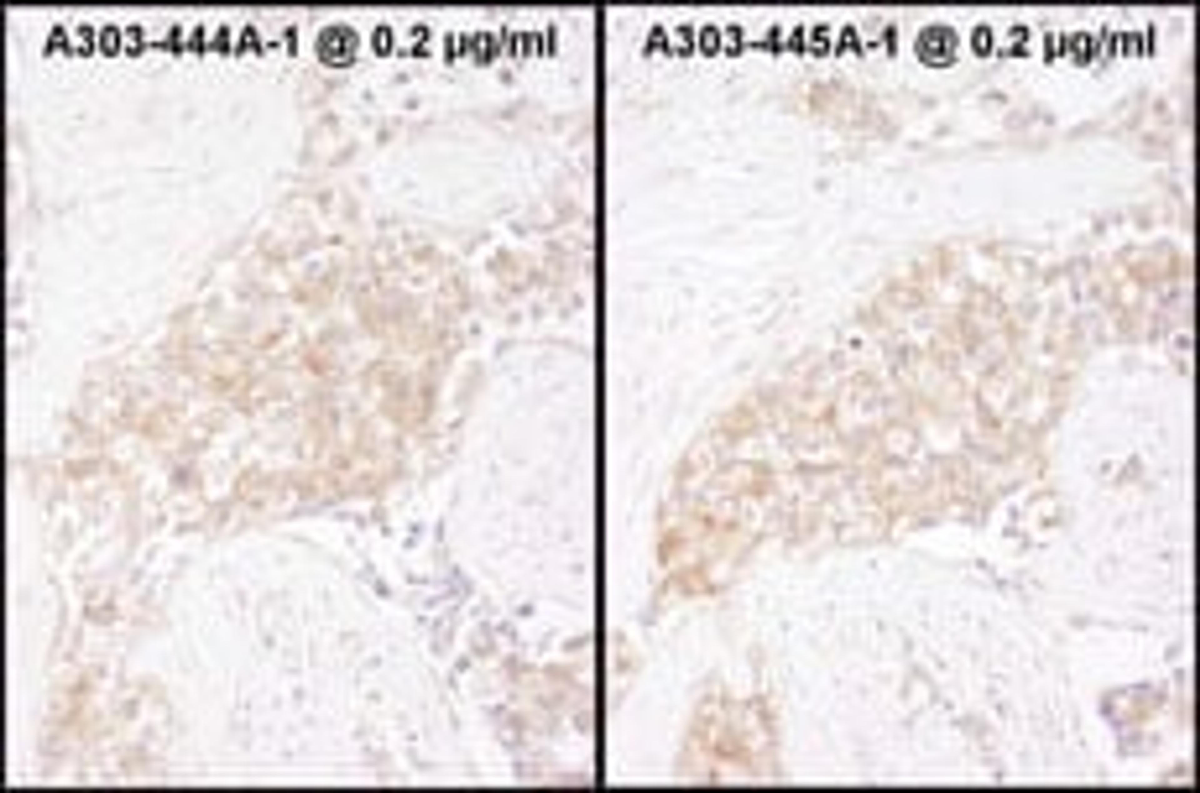 Detection of human TCP1 by immunohistochemistry.