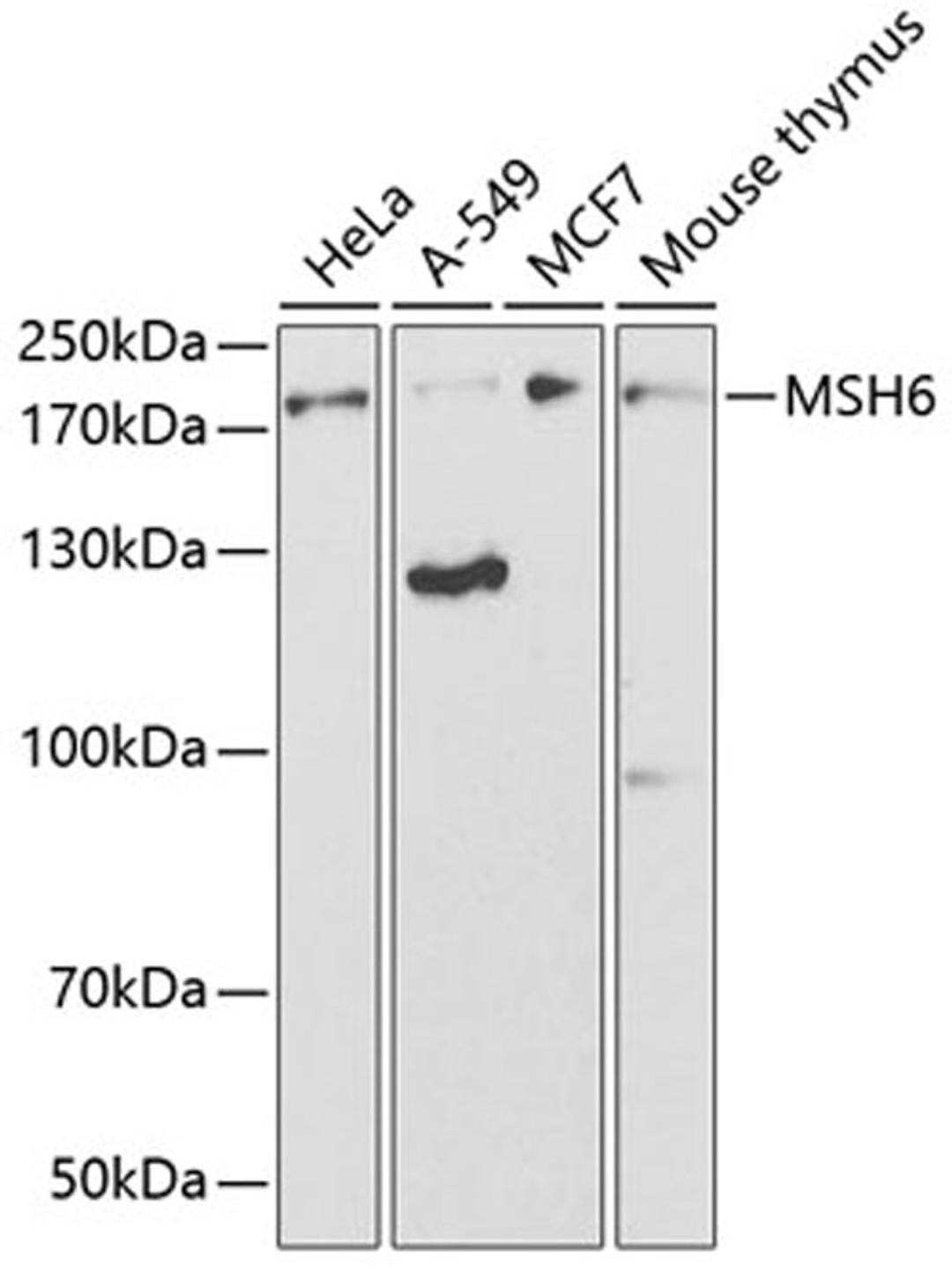 Western blot - MSH6 antibody (A3177)