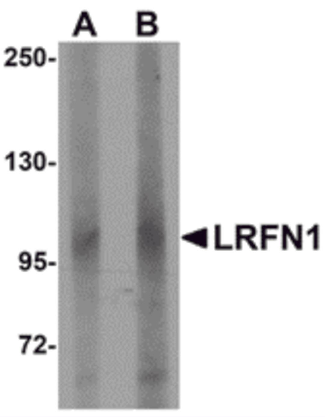 Western blot analysis of LRFN1 in human brain lysate with LRFN1 antibody at (A) 1 and (B) 2 &#956;g/mL.