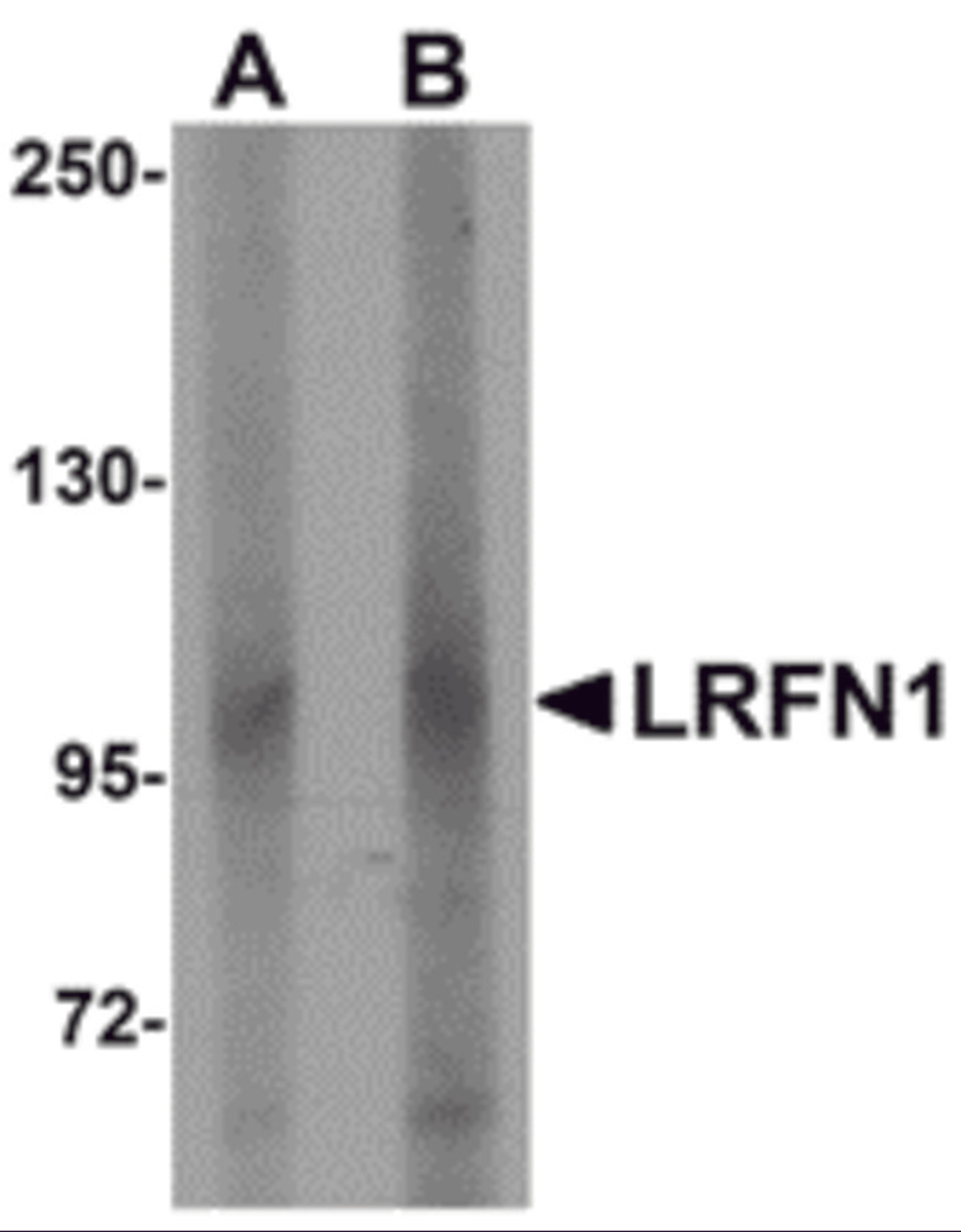 Western blot analysis of LRFN1 in human brain lysate with LRFN1 antibody at (A) 1 and (B) 2 &#956;g/mL.