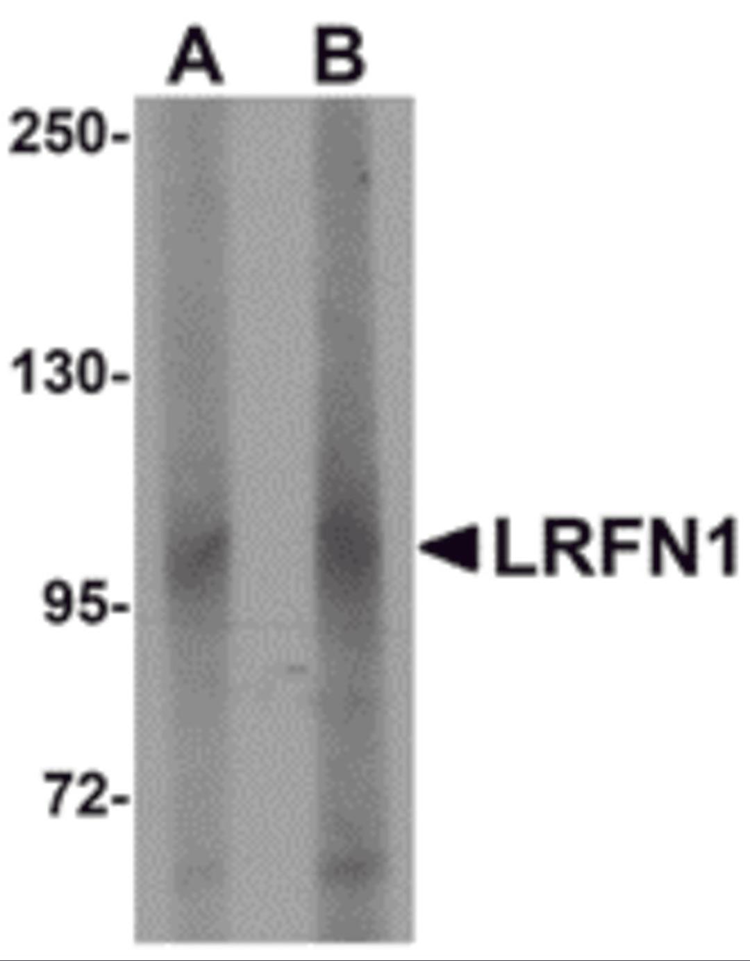 Western blot analysis of LRFN1 in human brain lysate with LRFN1 antibody at (A) 1 and (B) 2 μg/mL.