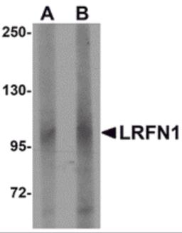 Western blot analysis of LRFN1 in human brain lysate with LRFN1 antibody at (A) 1 and (B) 2 μg/mL.