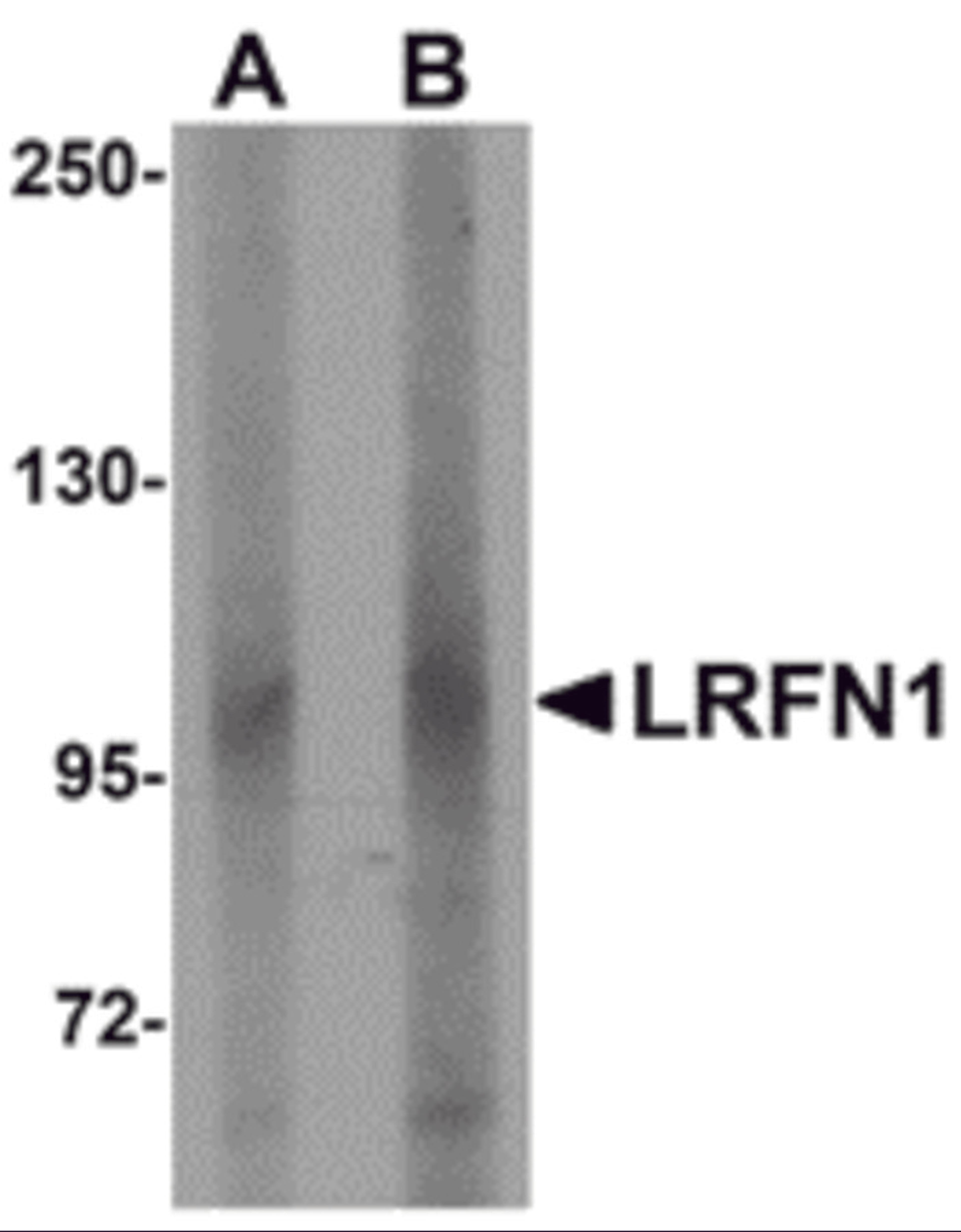 Western blot analysis of LRFN1 in human brain lysate with LRFN1 antibody at (A) 1 and (B) 2 μg/mL.
