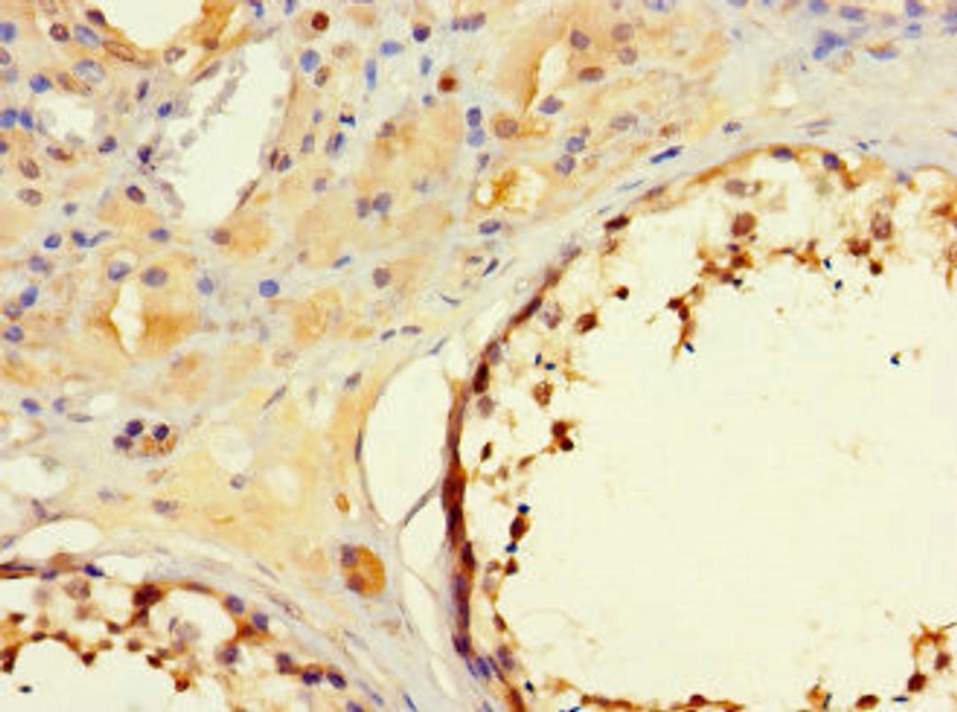 Immunohistochemistry of paraffin-embedded human testis tissue using CSB-PA803127LA01HU at dilution of 1:100