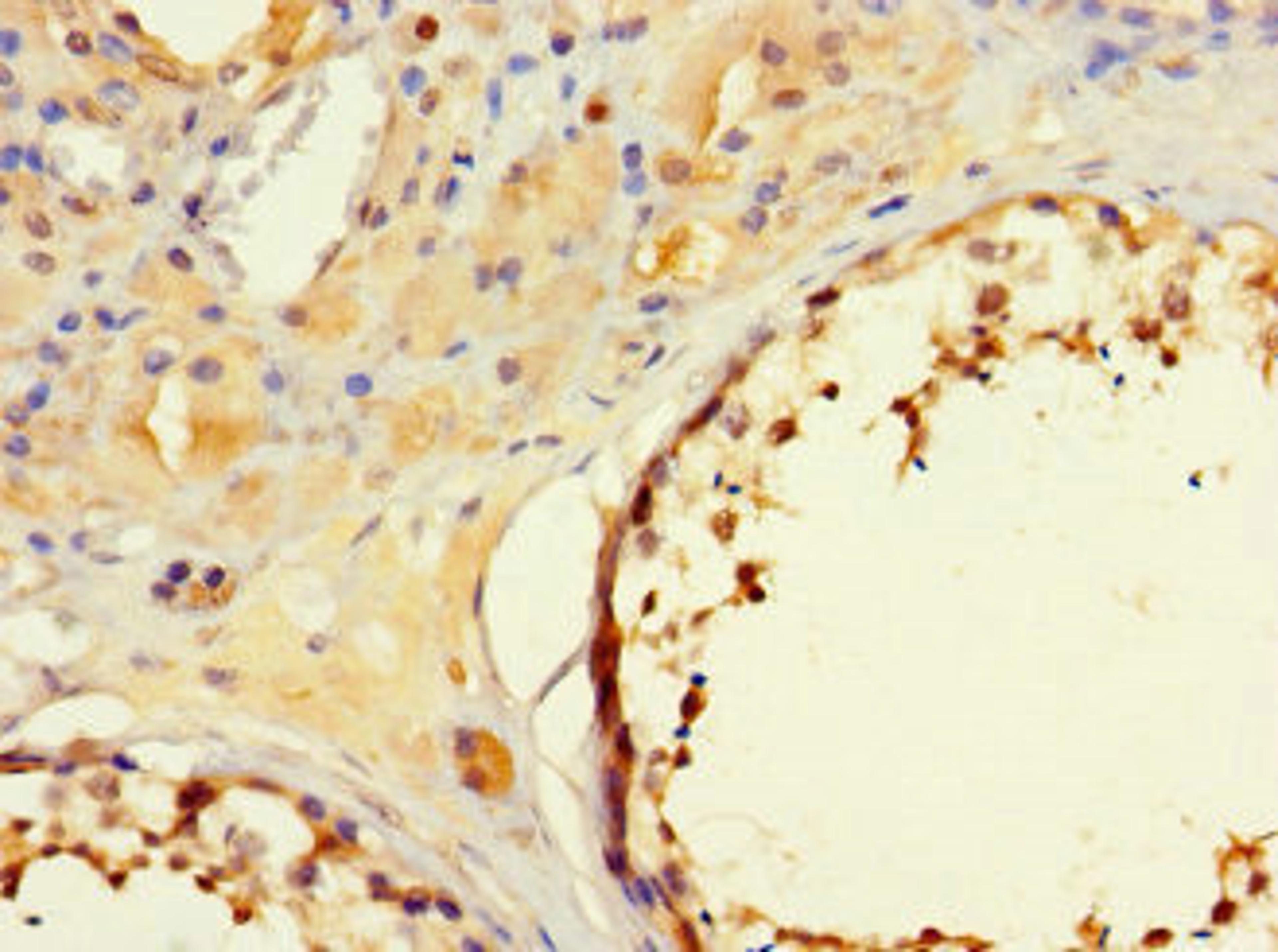 Immunohistochemistry of paraffin-embedded human testis tissue using CSB-PA803127LA01HU at dilution of 1:100