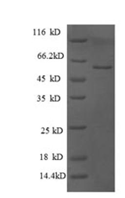 (Tris-Glycine gel) Discontinuous SDS-PAGE (reduced) with 5% enrichment gel and 15% separation gel.