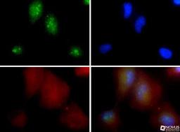 Immunocytochemistry/Immunofluorescence: Nucleophosmin Antibody [NB110-61646] - Nucleophosmin antibody was tested in HeLa cells with FITC (green). Nuclei and alpha-tubulin were counterstained with Dapi (blue) and Dylight 550 (red).