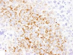 Detection of mouse GOT2 by immunohistochemistry.