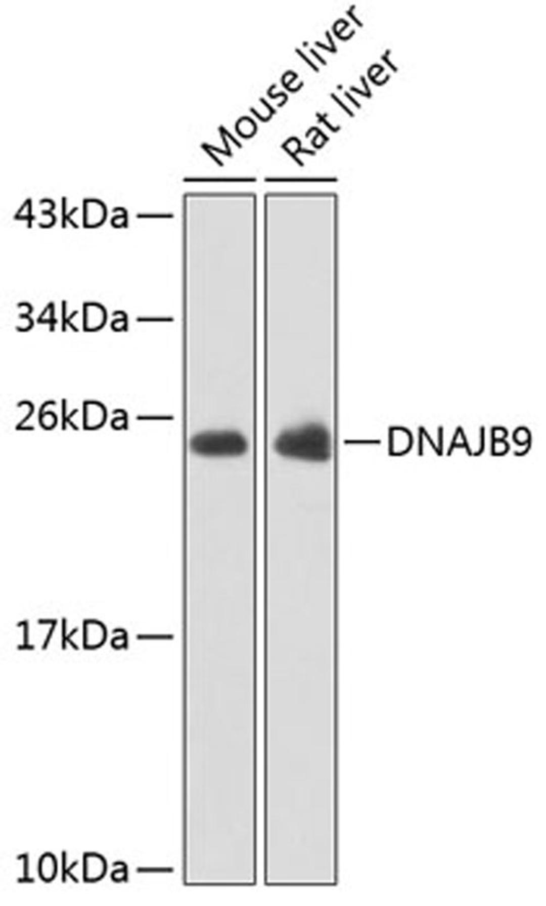 Western blot - DNAJB9 antibody (A7494)