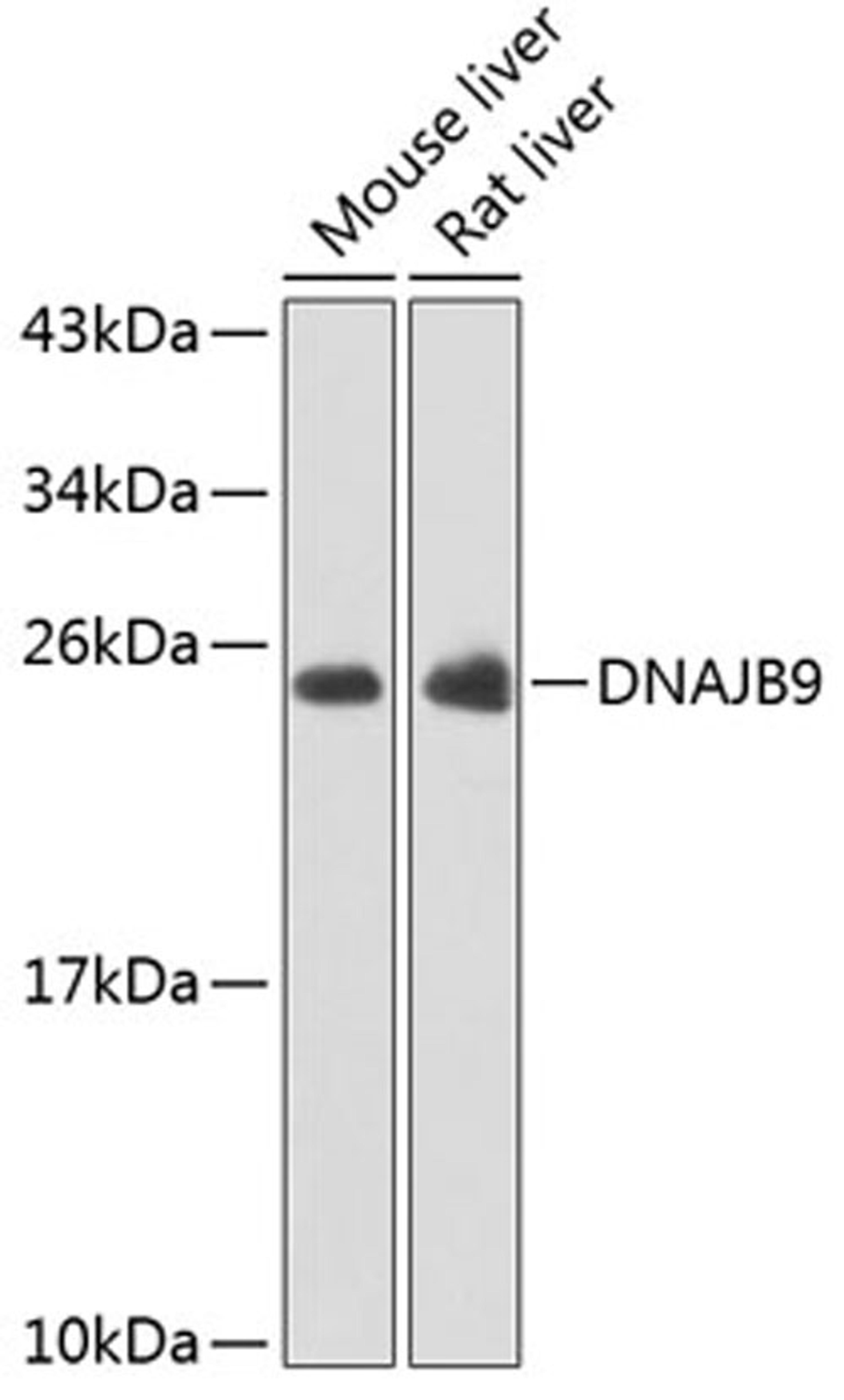 Western blot - DNAJB9 antibody (A7494)