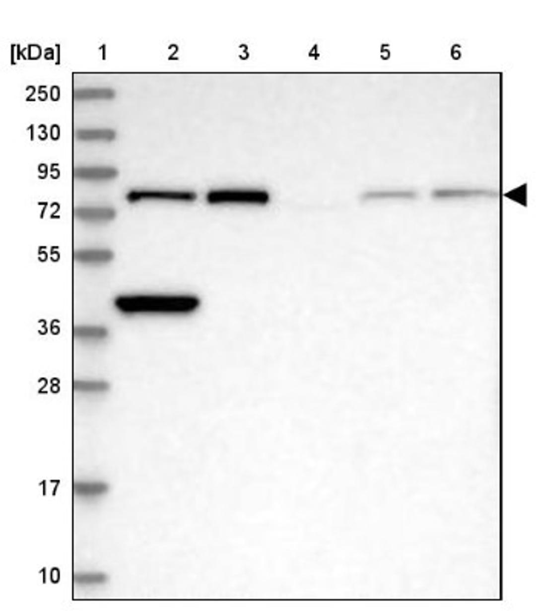 Western Blot: XPD Antibody [NBP2-38382] - Lane 1: Marker [kDa] 250, 130, 95, 72, 55, 36, 28, 17, 10<br/>Lane 2: RT-4<br/>Lane 3: U-251 MG<br/>Lane 4: Human Plasma<br/>Lane 5: Liver<br/>Lane 6: Tonsil