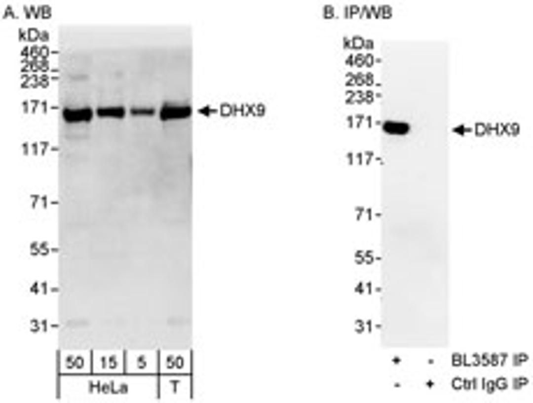 Detection of human DHX9 by western blot and immunoprecipitation.