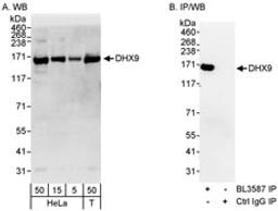 Detection of human DHX9 by western blot and immunoprecipitation.