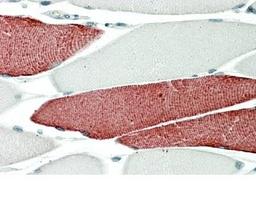 Immunohistochemistry-Paraffin: Troponin T Type 3 (fast skeletal) Antibody [NBP2-26199] - Staining of Human Skeletal Muscle. Steamed antigen retrieval with citrate buffer pH 6, AP-staining.