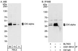 Detection of human CKI alpha by western blot and immunoprecipitation.