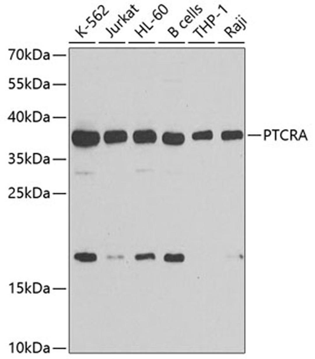 Western blot - PTCRA antibody (A7150)