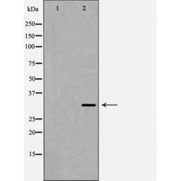 Western blot analysis of HeLa cells using TSG6 antibody