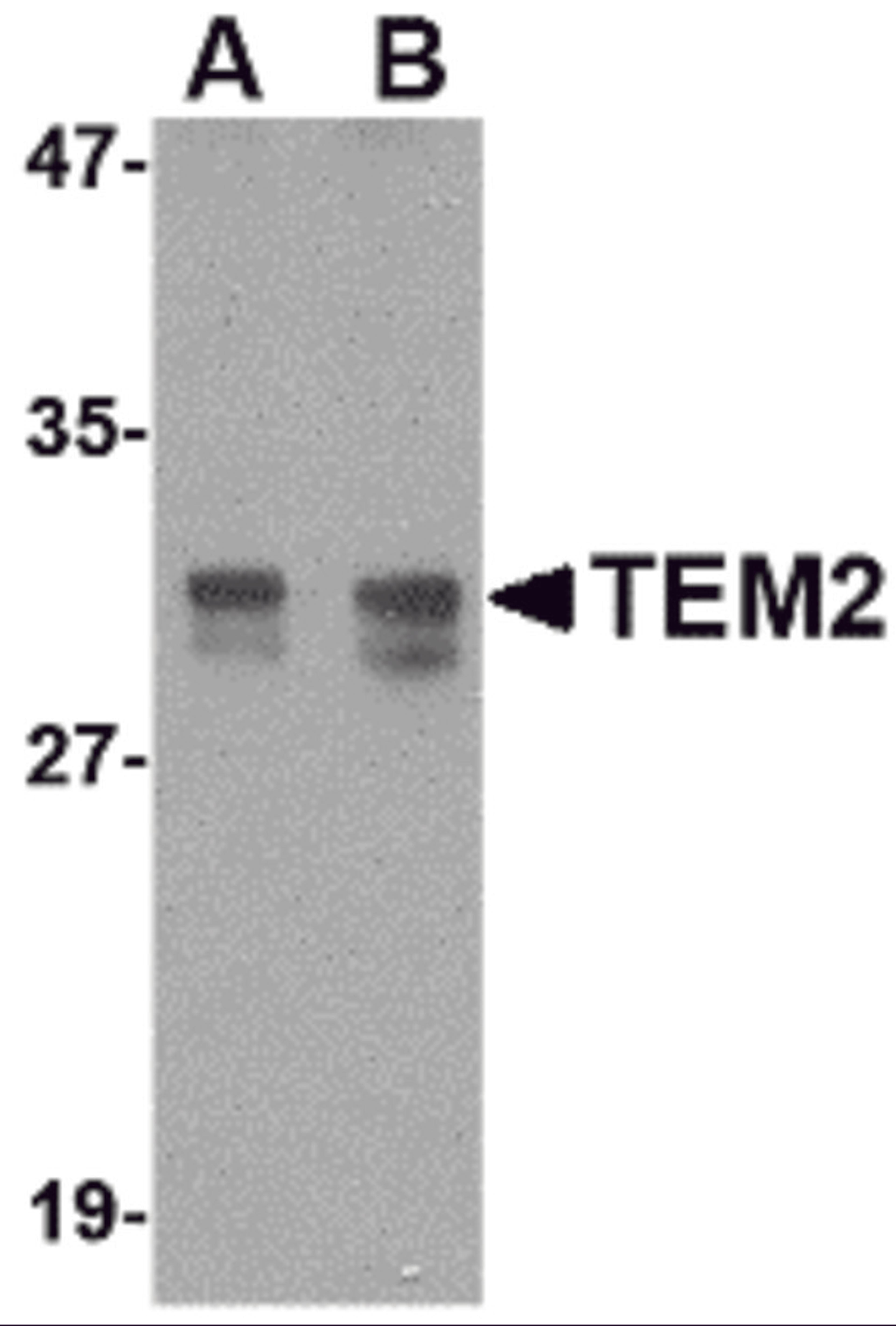 Western blot analysis of TEM2 in rat colon tissue lysate with TEM2 antibody at (A) 1 and (B) 2 &#956;g/mL.