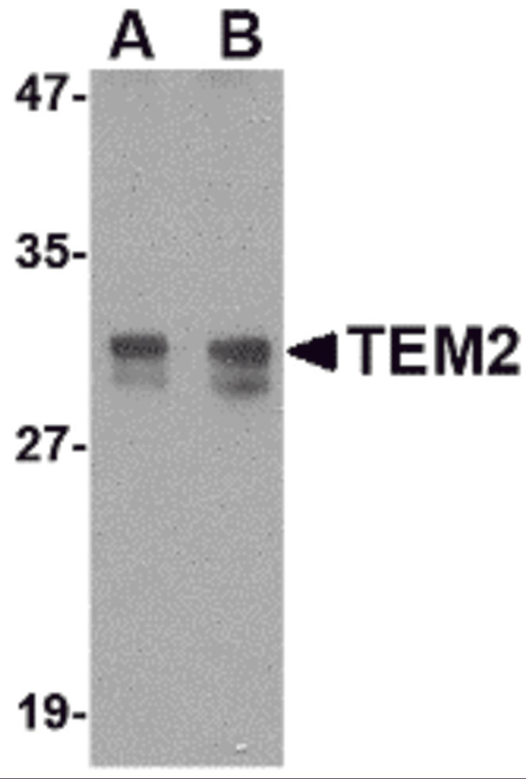 Western blot analysis of TEM2 in rat colon tissue lysate with TEM2 antibody at (A) 1 and (B) 2 μg/mL.