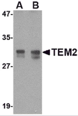 Western blot analysis of TEM2 in rat colon tissue lysate with TEM2 antibody at (A) 1 and (B) 2 μg/mL.