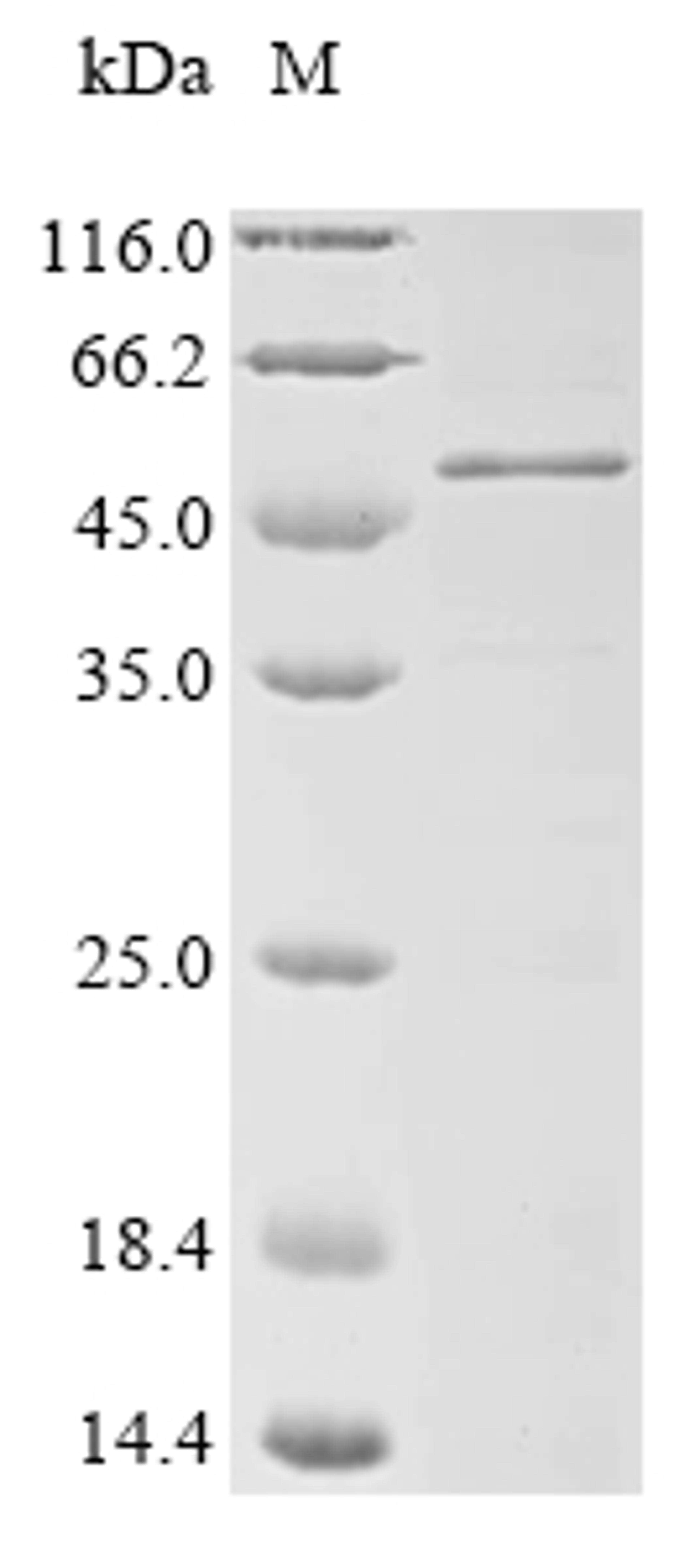 (Tris-Glycine gel) Discontinuous SDS-PAGE (reduced) with 5% enrichment gel and 15% separation gel.