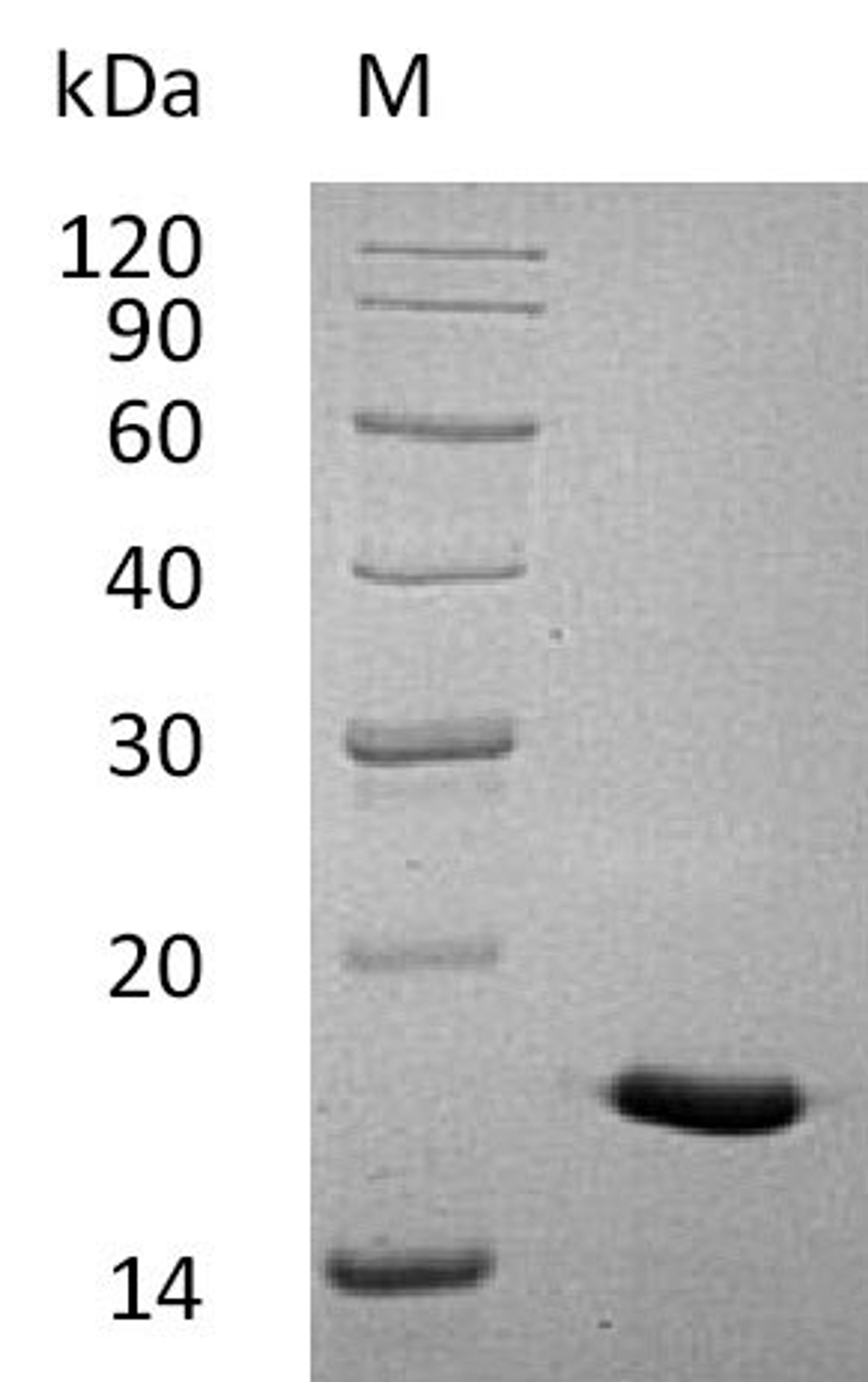 (Tris-Glycine gel) Discontinuous SDS-PAGE (reduced) with 5% enrichment gel and 15% separation gel.