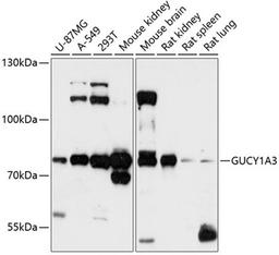 Western blot - GUCY1A3 antibody (A12710)