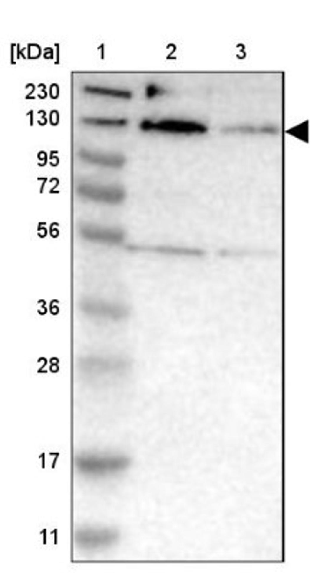 Western Blot: MORC3 Antibody [NBP1-83036] - Lane 1: Marker [kDa] 230, 130, 95, 72, 56, 36, 28, 17, 11<br/>Lane 2: Human cell line RT-4<br/>Lane 3: Human cell line U-251MG sp