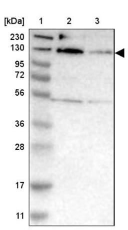 Western Blot: MORC3 Antibody [NBP1-83036] - Lane 1: Marker [kDa] 230, 130, 95, 72, 56, 36, 28, 17, 11<br/>Lane 2: Human cell line RT-4<br/>Lane 3: Human cell line U-251MG sp