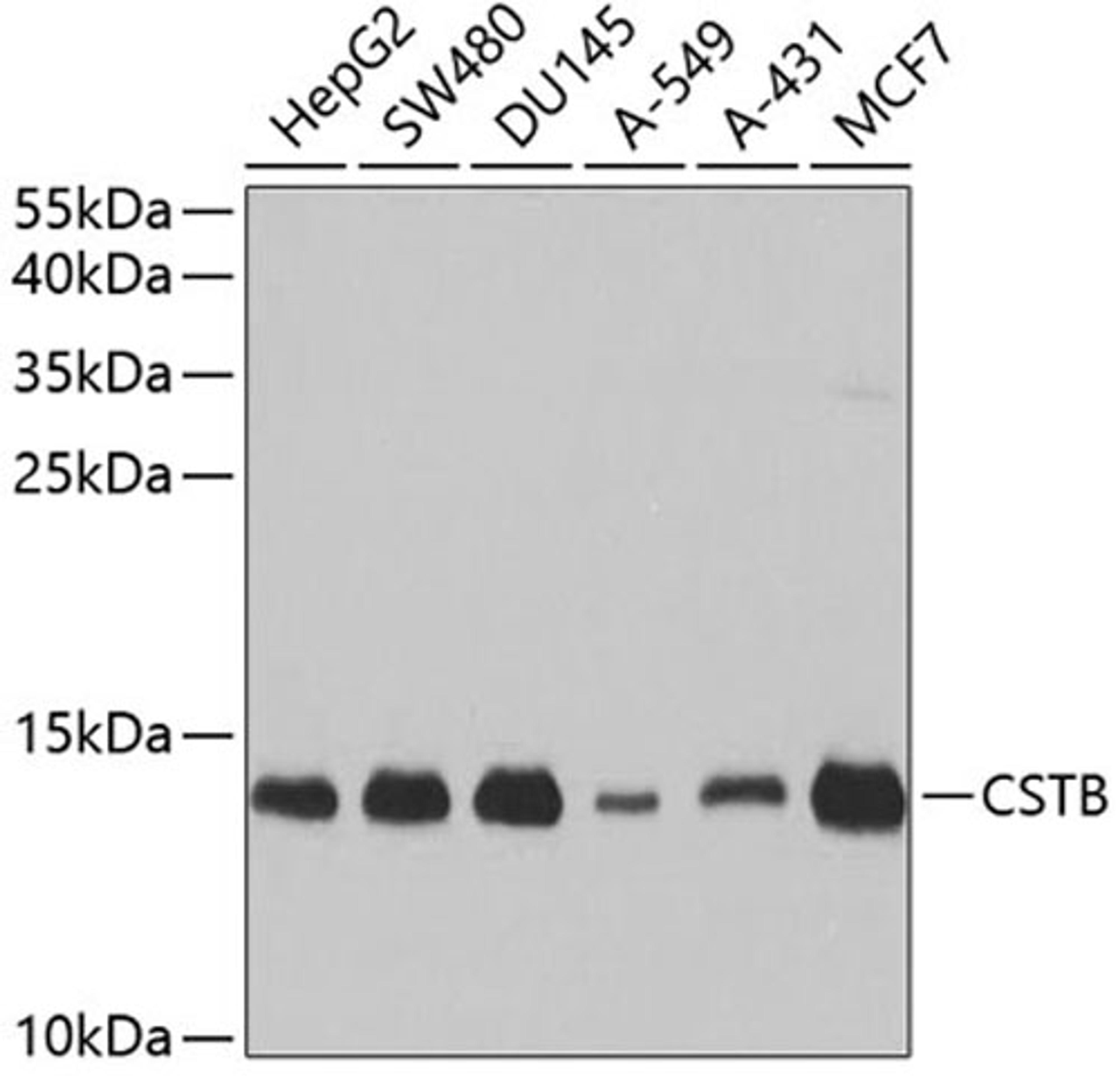 Western blot - CSTB antibody (A3815)