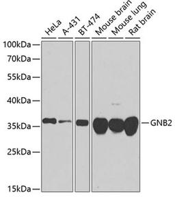 Western blot - GNB2 antibody (A8422)