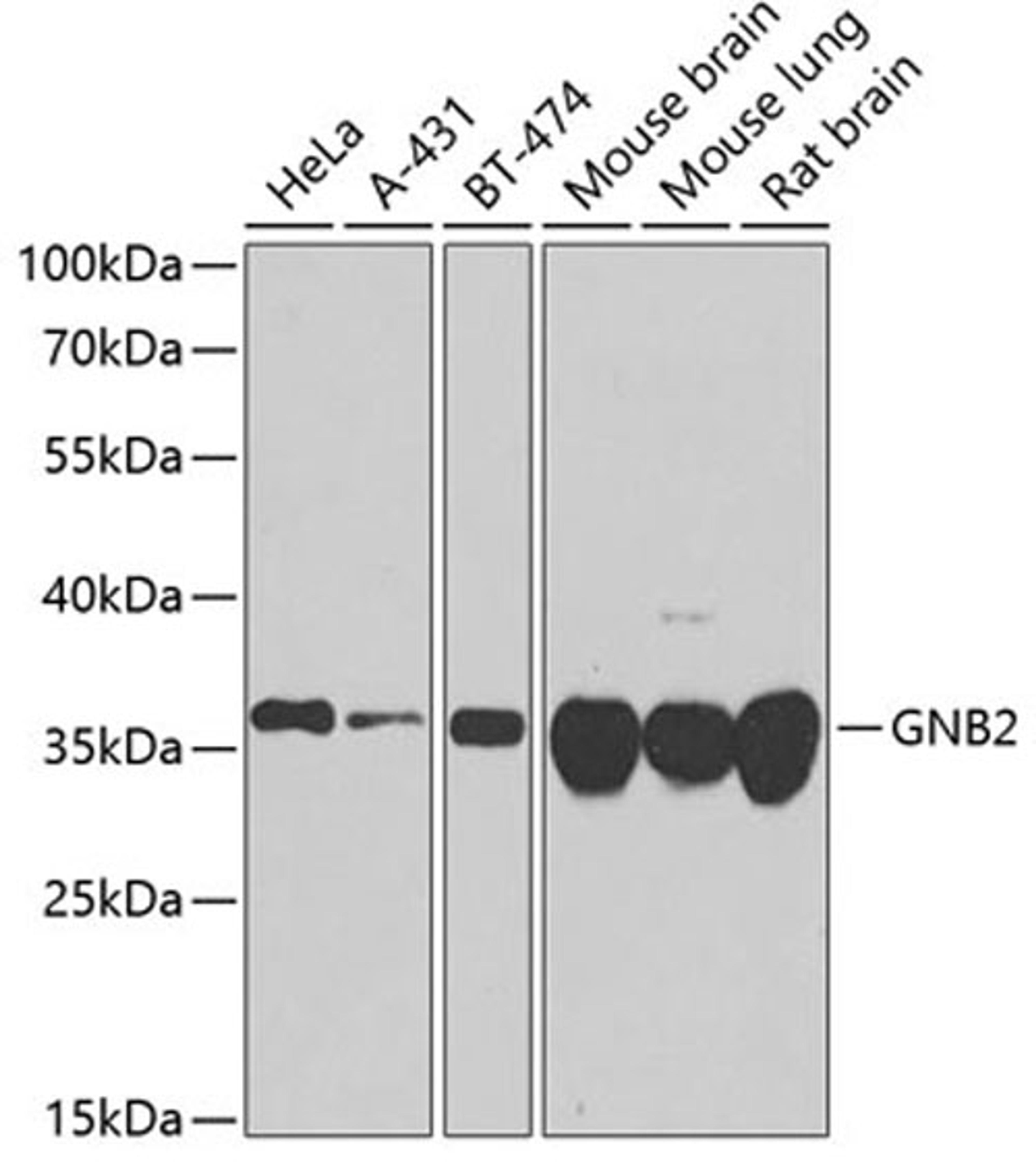 Western blot - GNB2 antibody (A8422)