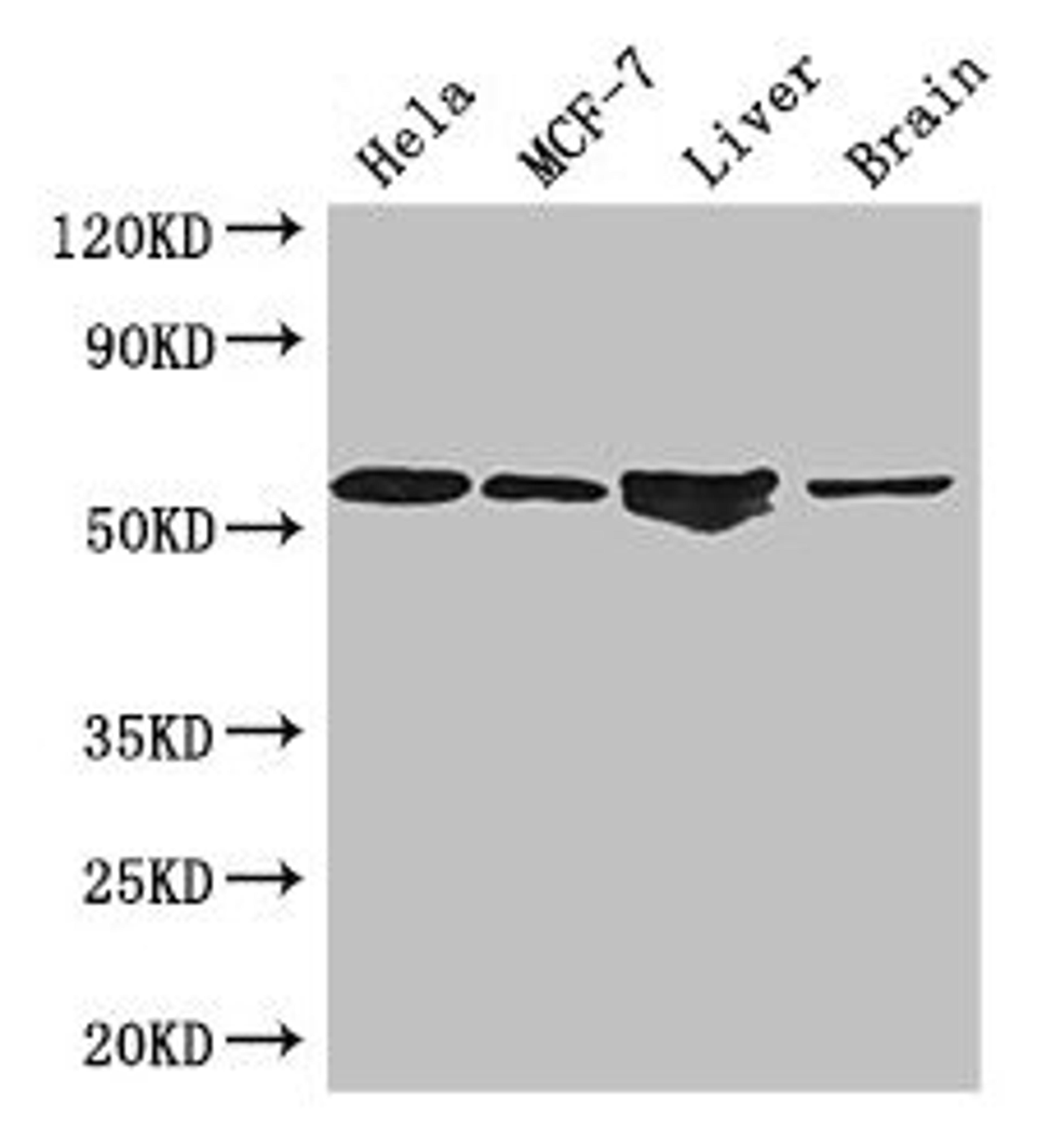 Western Blot. Positive WB detected in: Hela whole cell lysate, MCF-7 whole cell lysate, Mouse liver tissue, Mouse brain tissue. All lanes: ETS2 antibody at 2.7µg/ml. Secondary. Goat polyclonal to rabbit IgG at 1/50000 dilution. Predicted band size: 54 kDa. Observed band size: 54 kDa