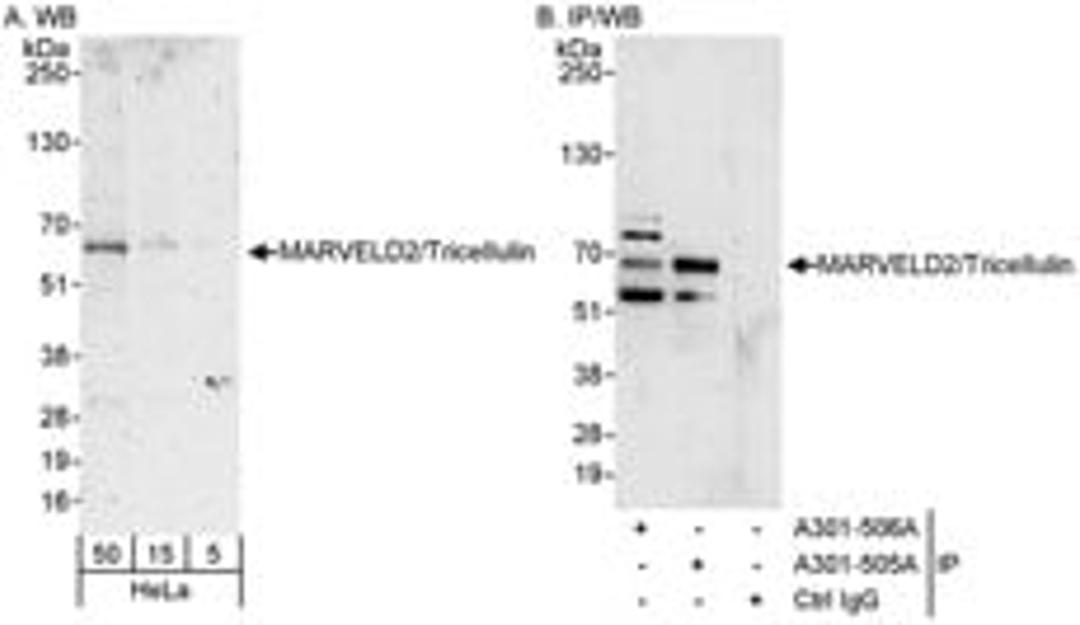 Detection of human MARVELD2/Tricellulin by western blot and immunoprecipitation.