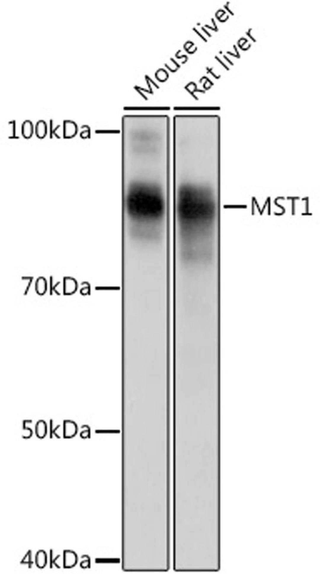 Western blot - MST1 Rabbit mAb (A0109)