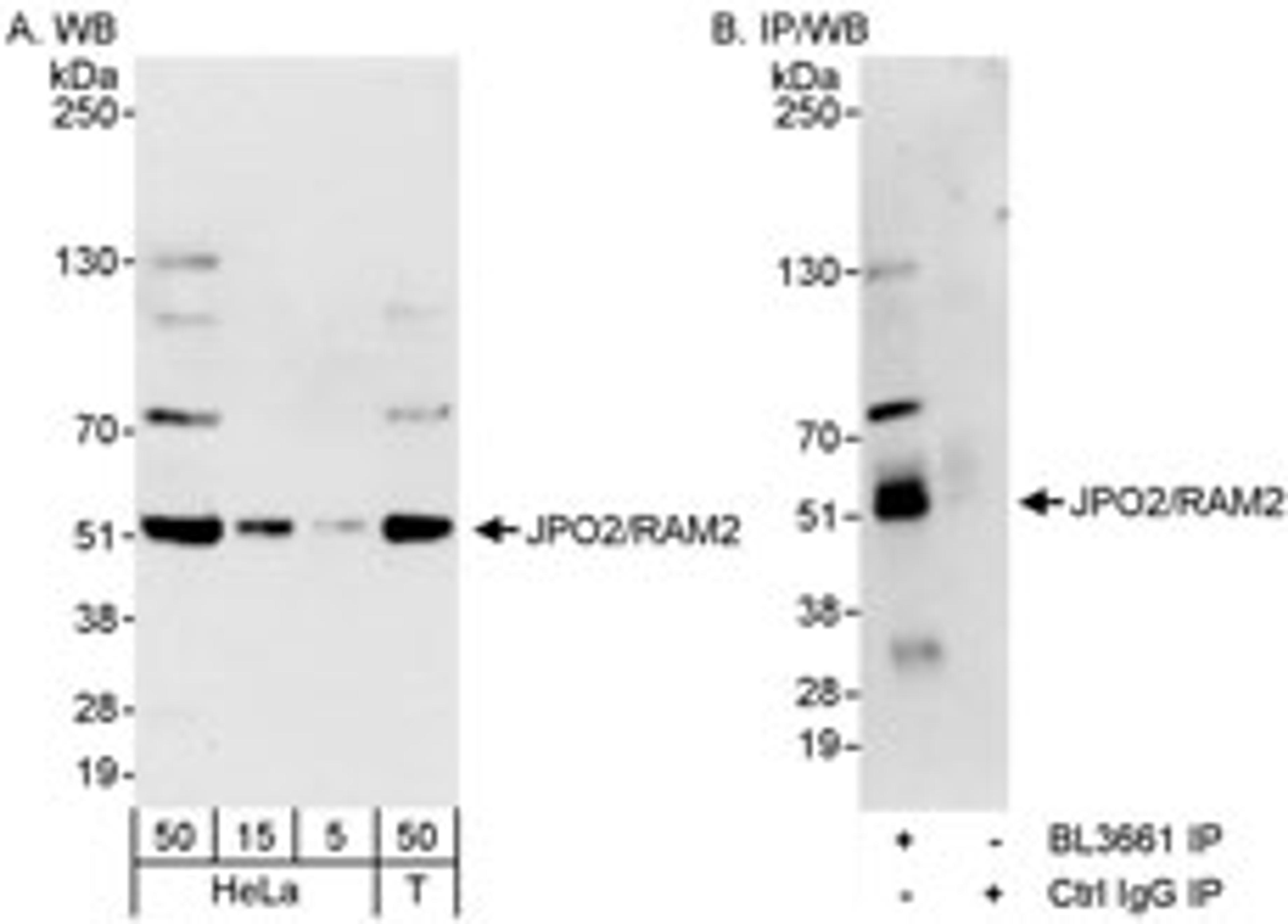 Detection of human JPO2/RAM2 by western blot and immunoprecipitation.