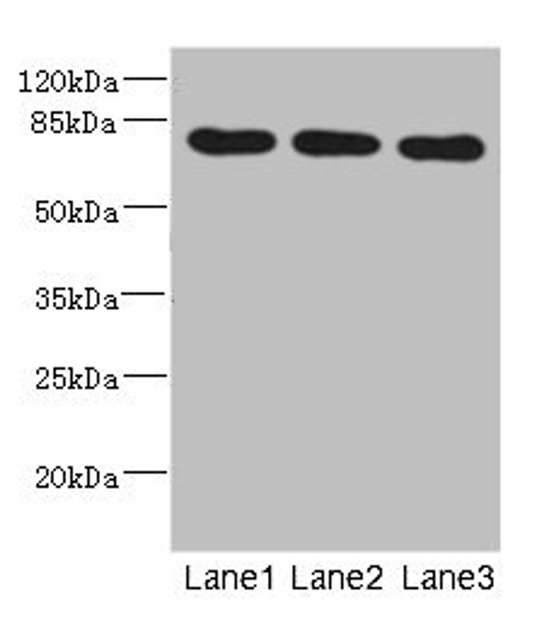 Western blot. All lanes: BBS2 antibody at 5.01ug/ml. Lane 1: Mouse liver tissue. Lane 2: Mouse brain tissue. Lane 3: Mouse gonadal tissue. Secondary. Goat polyclonal to rabbit IgG at 1/10000 dilution. Predicted band size: 80 kDa. Observed band size: 80 kDa.