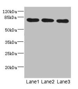 Western blot. All lanes: BBS2 antibody at 5.01ug/ml. Lane 1: Mouse liver tissue. Lane 2: Mouse brain tissue. Lane 3: Mouse gonadal tissue. Secondary. Goat polyclonal to rabbit IgG at 1/10000 dilution. Predicted band size: 80 kDa. Observed band size: 80 kDa.