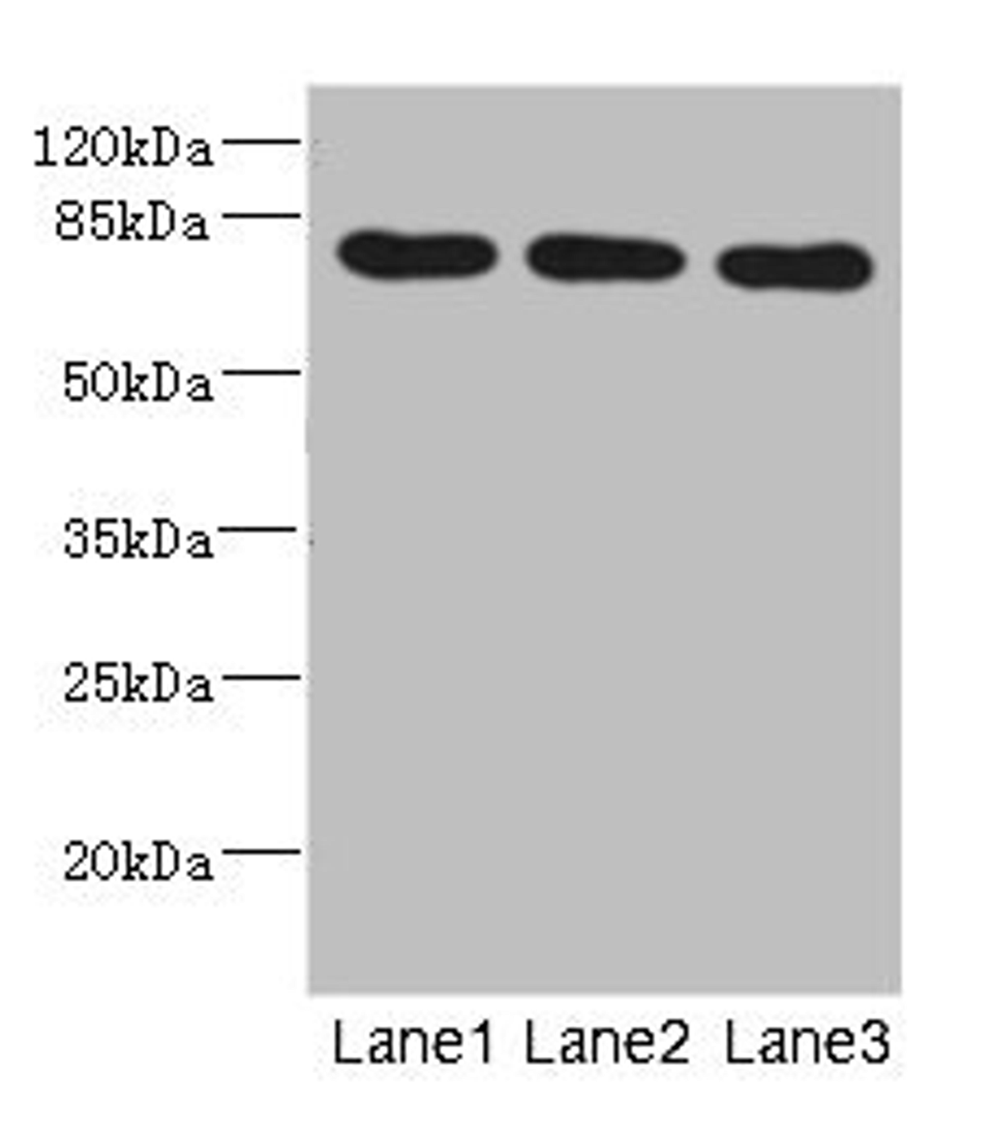 Western blot. All lanes: BBS2 antibody at 5.01ug/ml. Lane 1: Mouse liver tissue. Lane 2: Mouse brain tissue. Lane 3: Mouse gonadal tissue. Secondary. Goat polyclonal to rabbit IgG at 1/10000 dilution. Predicted band size: 80 kDa. Observed band size: 80 kDa.